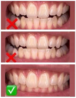 نمونه عکس برای ارسال کامپوزیت