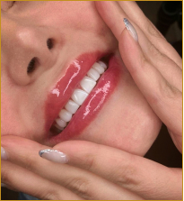 کامپوزیت دندان زیبا