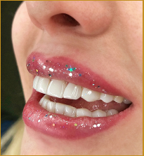 کامپوزیت دندان درخشان