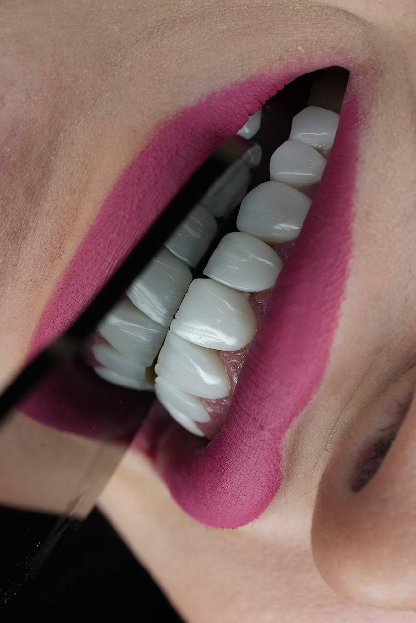 کامپوزیت دندان قشنگ