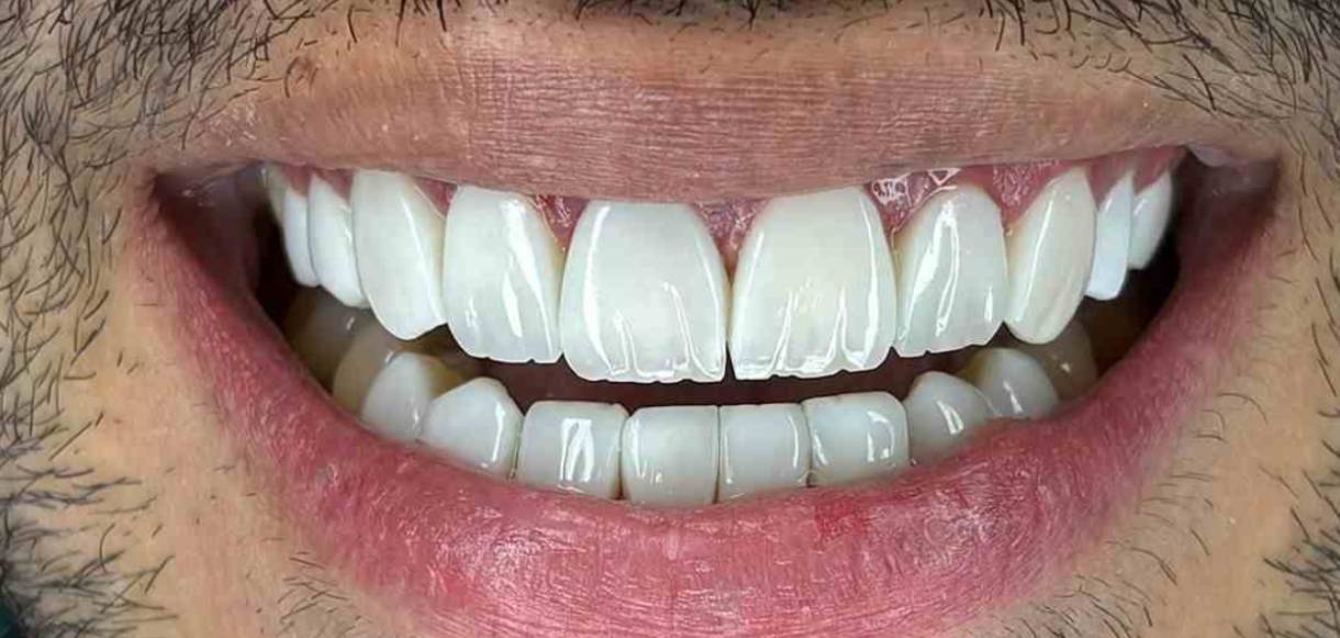 یعد کامپوزیت یعد کامپوزیت