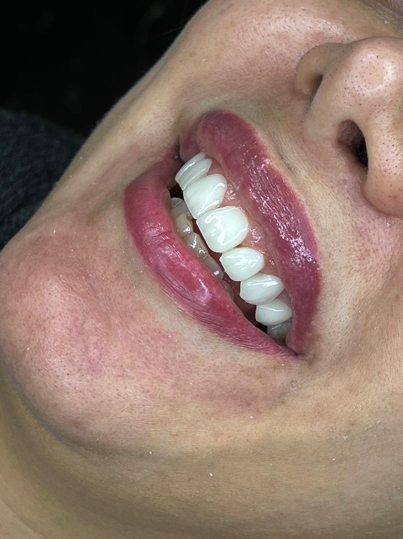 لمینیت با تراش کم