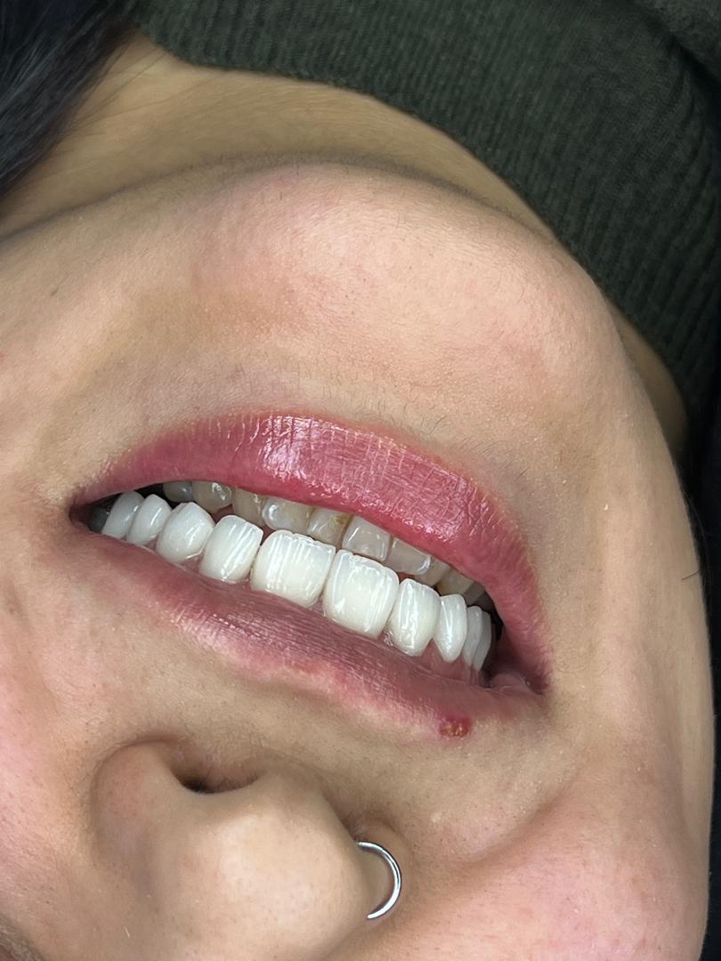 لمینیت بدون تراش