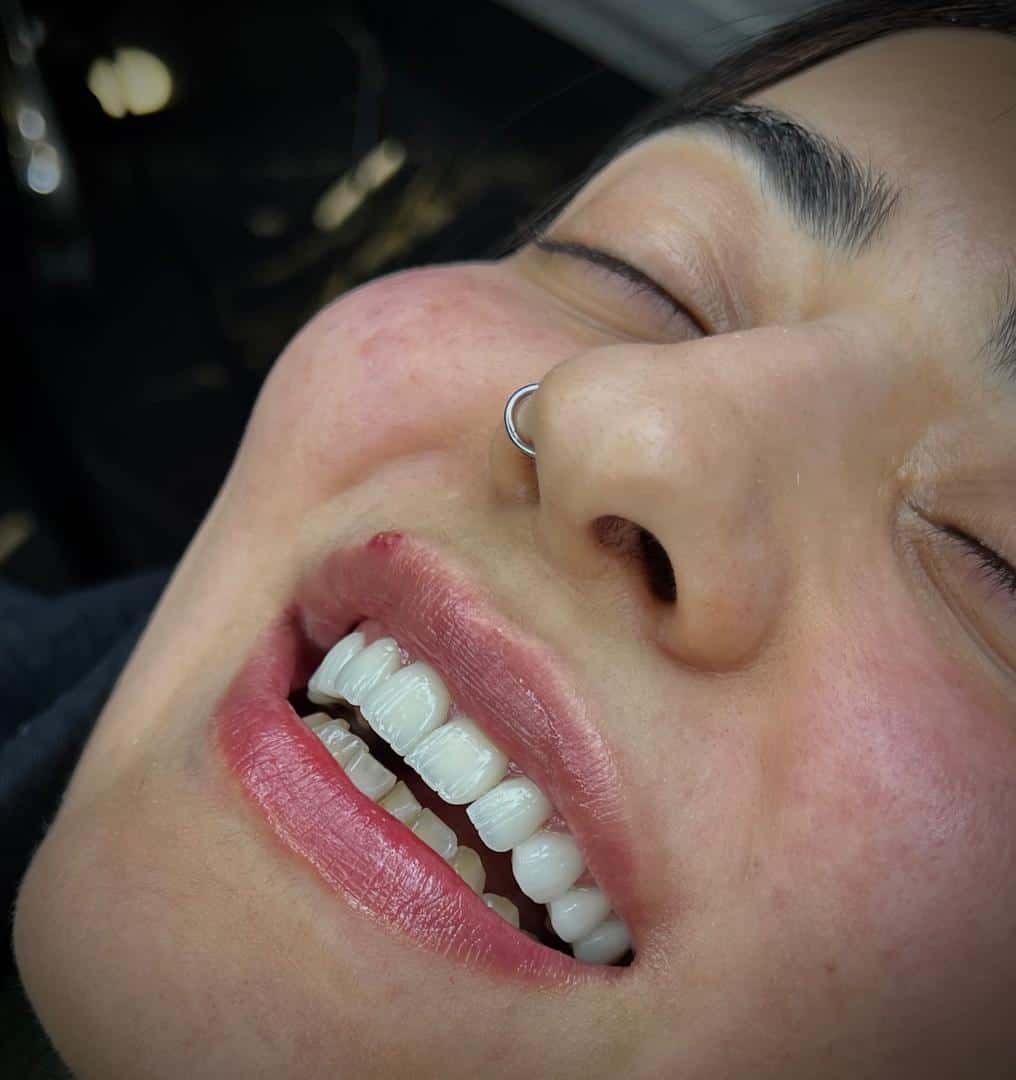 لمینیت سفید