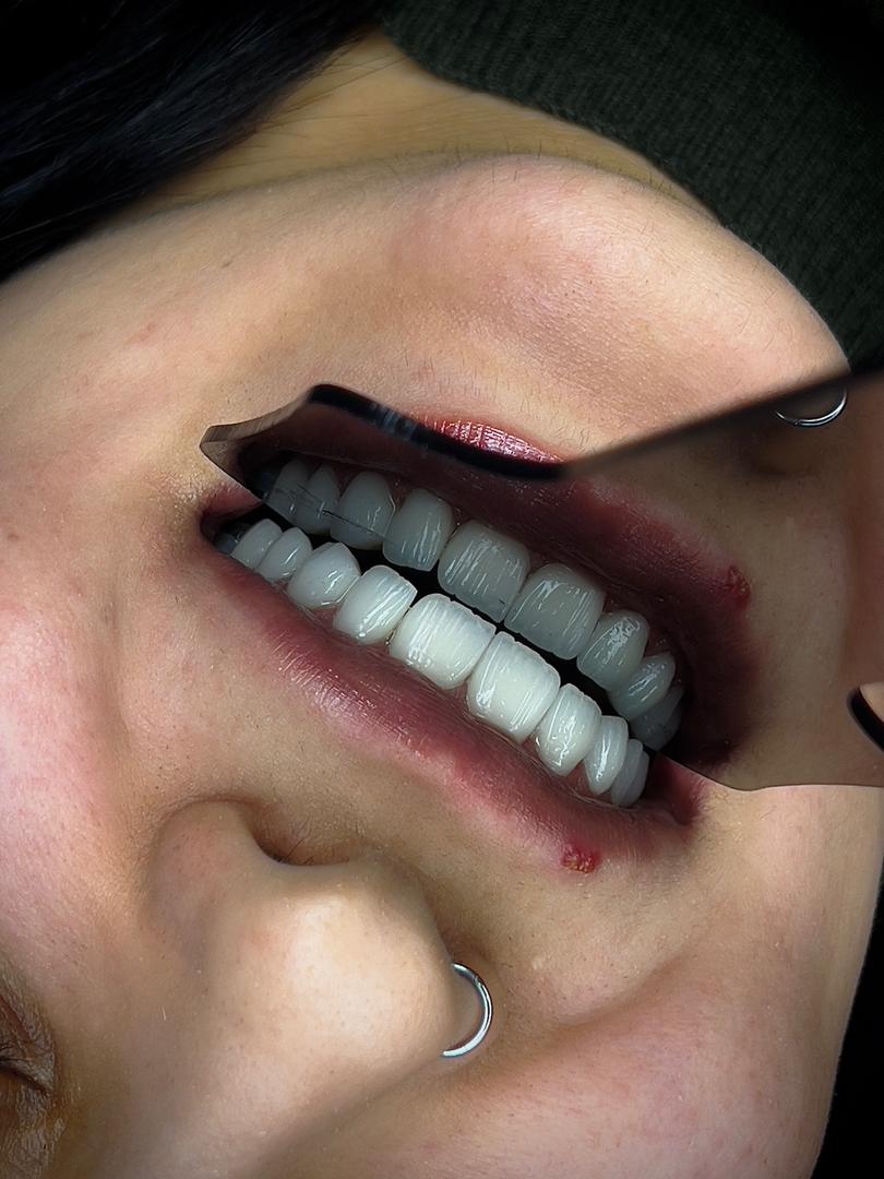 لمینیت سفید